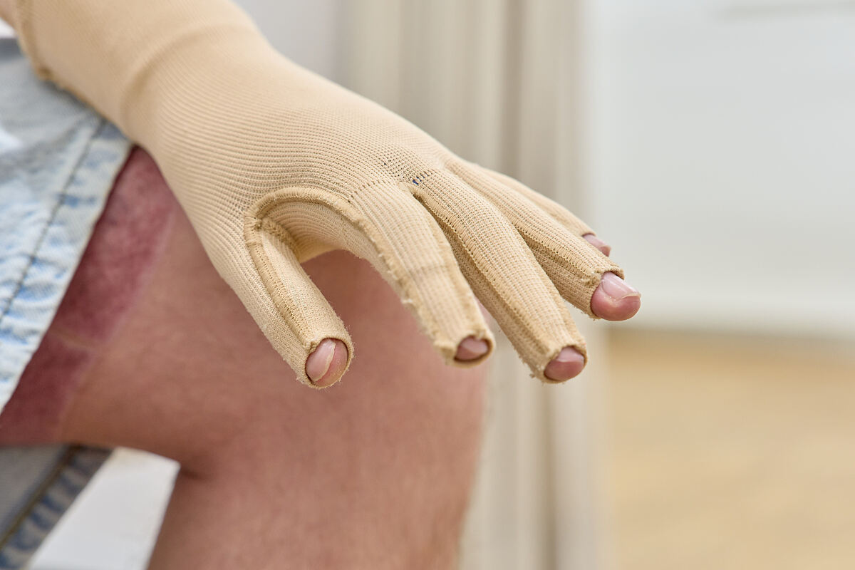 Enfilage autonome d’un gant de compression  Anziehen eines Kompressions-Handschuhs (selbstständig)