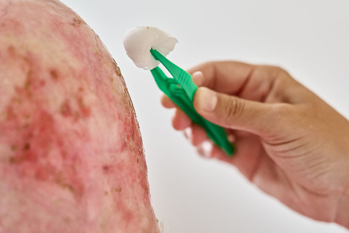Soins de plaies  Wundversorgung