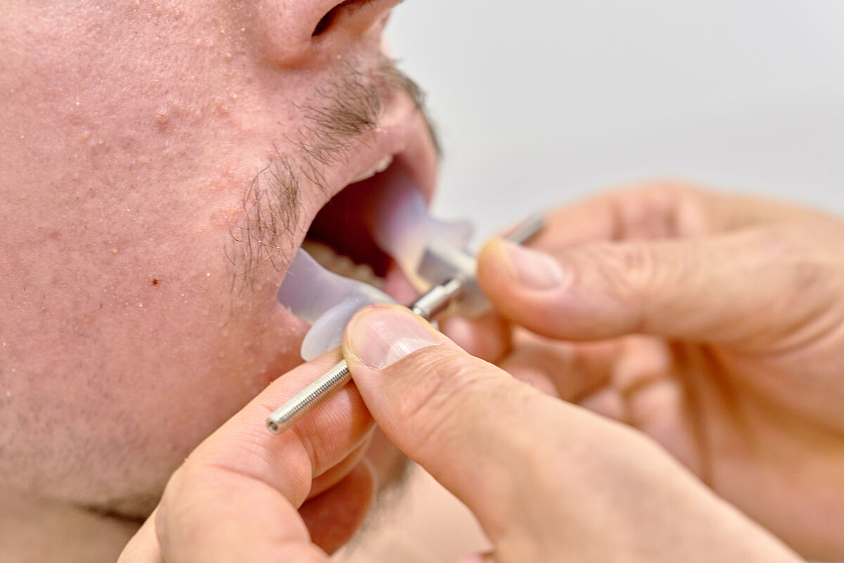 Ecarteur buccal  Mundspreizer